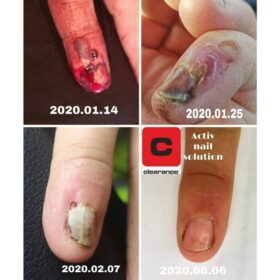 Active Nail Solution -Clearance (15ml)