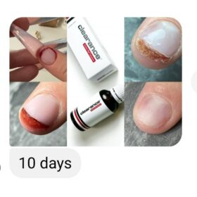 active-nail-solution-open