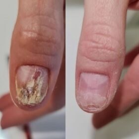 ACTIVE NAIL SOLUTION - CLEARANCE (15ml) - immagine 5