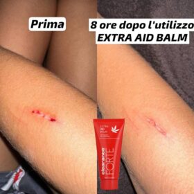 AID BALM