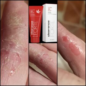 AID BALM