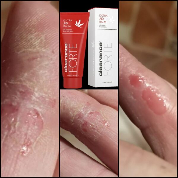 AID BALM