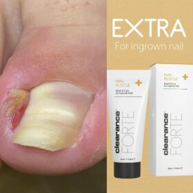NAIL RESCUE -Clearance