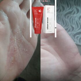 AID BALM