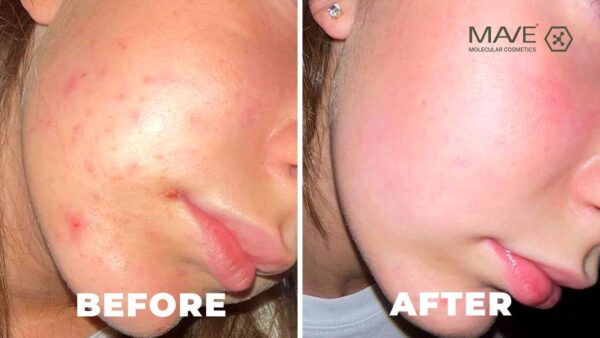Organic Paste skin repair 15ml -MAVE