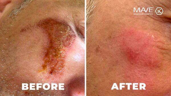 Organic Paste skin repair 15ml -MAVE