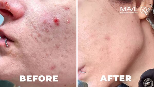 Organic Paste skin repair 15ml -MAVE