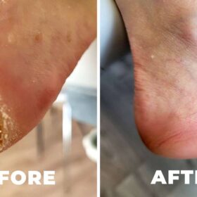 Organic Paste skin repair 15ml -MAVE e Molecular Oil Treatment 100ml
