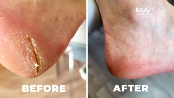 Organic Paste skin repair 15ml -MAVE e Molecular Oil Treatment 100ml