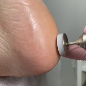 Corso PEDICURE con PODO DISCO in presenza