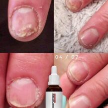 Prodotti professionali per le unghie | Diana Nails Shop 8 ACTIVE NAIL SOLUTION 30ML